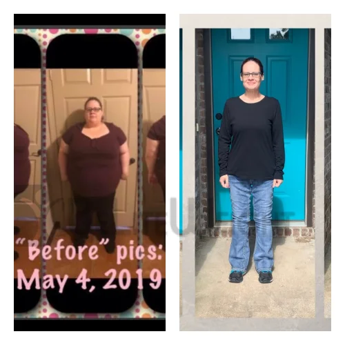 Leslie M - 2 Year Update*